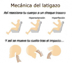 abogados expertos en accidentes de trafico
